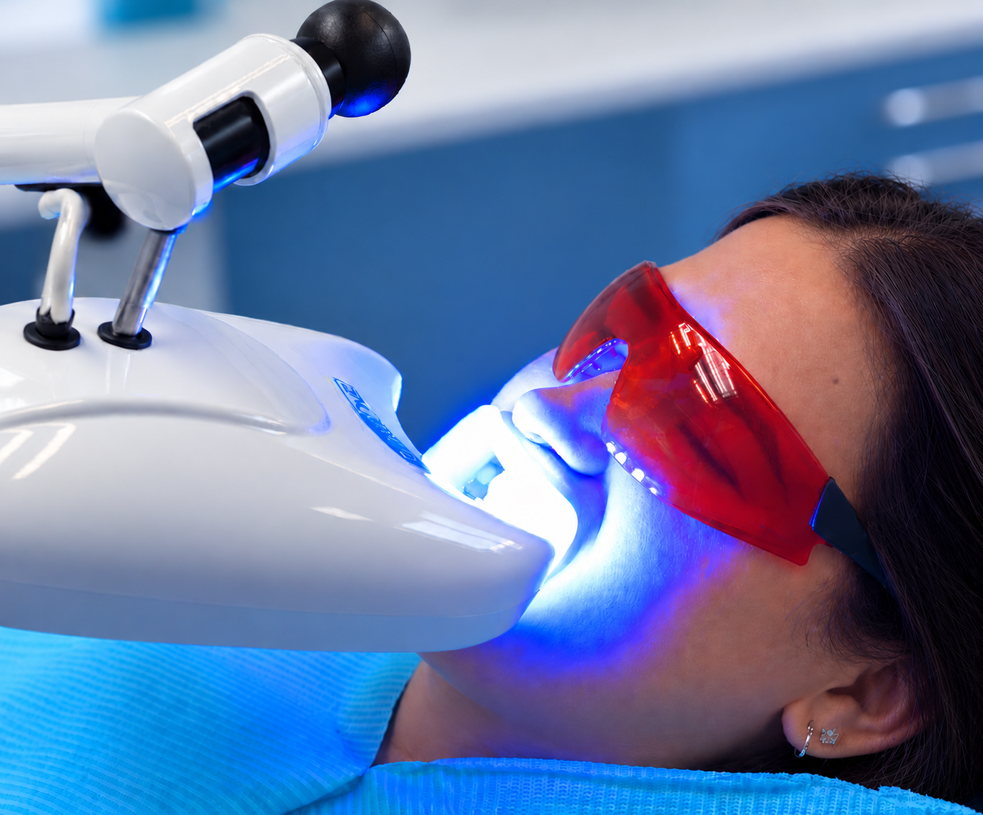 BlancOne teeth whitening at Argo Dental Clinic